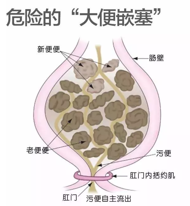 捕获.PNG